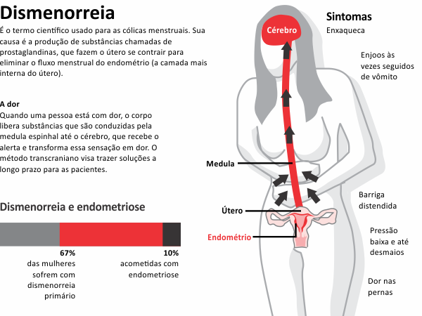 7 causas da menstruação irregular - Clinifemina